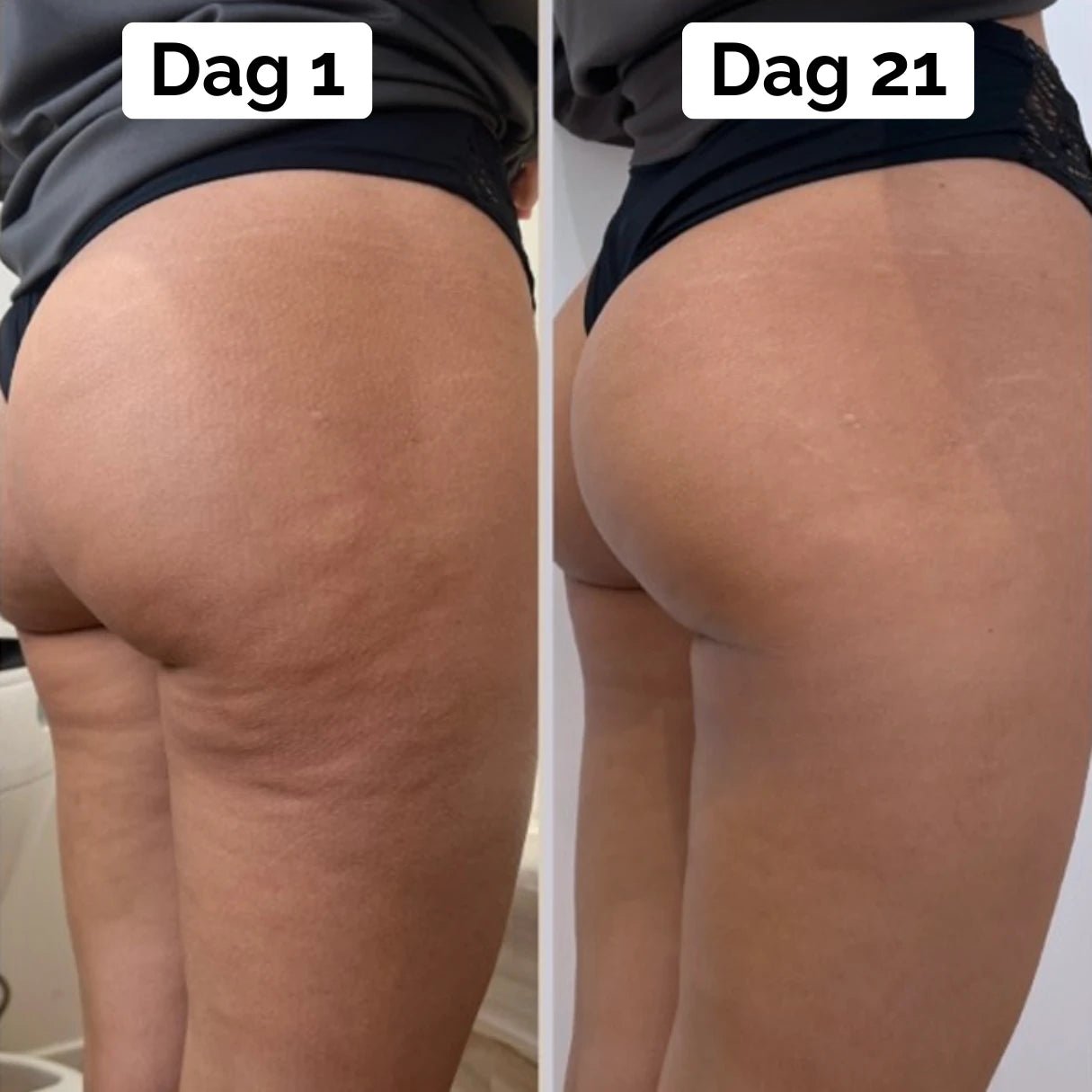 BodySculp 2.0 Slim Pro - Få drømmekroppen din - AVABeauty.no